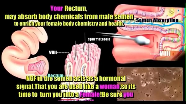 anatomía transexual